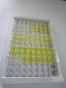 ELISA Kit for Sclerostin (SOST)