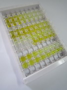 ELISA Kit for Chromogranin B (CHGB)