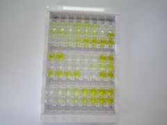 ELISA Kit for Cannabinoid Receptor 1, Brain (CNR1)