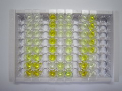 ELISA Kit for Glutamine synthetase (GS)