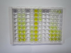 ELISA Kit for Phospholipase A2, Group IIA (PLA2G2A)