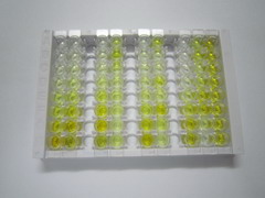 ELISA Kit for Crystallin Beta A1 (CRYbA1)