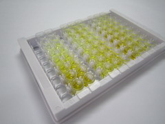 ELISA Kit for Carnitine Palmitoyltransferase 1A, Liver (CPT1A)