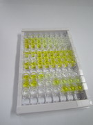 ELISA Kit for Leukocyte Cell Derived Chemotaxin 2 (LECT2)