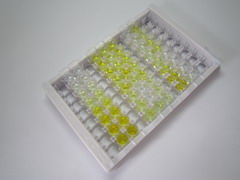 ELISA Kit for Glycogen Synthase 2, Liver (GYS2)