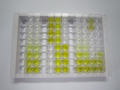 ELISA Kit for Absent In Melanoma 2 (AIM2)