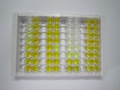 ELISA Kit for Arylsulfatase B (ARSB)