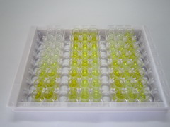 ELISA Kit for Tropomodulin 3 (TMOD3)