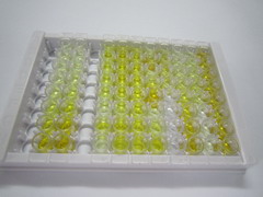 ELISA Kit for Thyroid Transcription Factor 1 (TITF1)