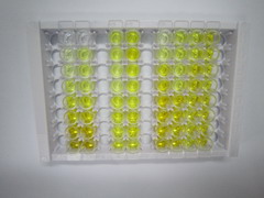 ELISA Kit for TANK Binding Kinase 1 (TBK1)