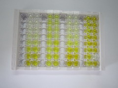 ELISA Kit for Serine Peptidase Inhibitor Kazal Type 1 (SPINK1)