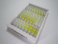 ELISA Kit for Fragile X Mental Retardation 1 (FMR1)