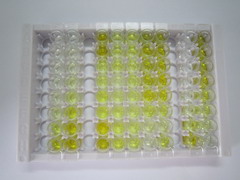 ELISA Kit for DNA Methyltransferase 3B (DNMT3B)