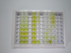 ELISA Kit for Cancer/Testis Antigen 1B (CTAG1B)