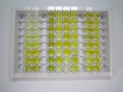 ELISA Kit for Lecithin Cholesterol Acyltransferase (LCAT)