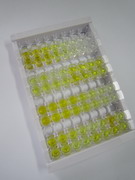 ELISA Kit for Hydroxyacyl Coenzyme A Dehydrogenase Beta (HADHb)