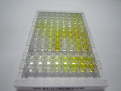 ELISA Kit for Insulin Like Growth Factor 2 mRNA Binding Protein 3 (IGF2BP3)