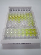 ELISA Kit for Protein Kinase, cAMP Dependent Regulatory Type II Beta (PRKAR2b)