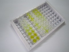 ELISA Kit for Exosome Component 7 (EXOSC7)