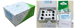 ELISA Kit for Interleukin 2 (IL2)